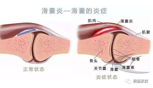 【解剖】膝关节系统解剖图 矢状mri 示意图