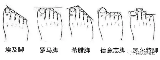 不同脚型如何挑选适合自己的鞋子