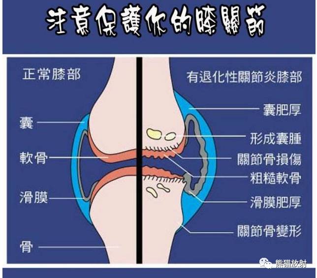 解剖膝关节系统解剖图矢状mri示意图