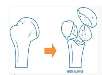 东北人口癖_东北人揣手图片