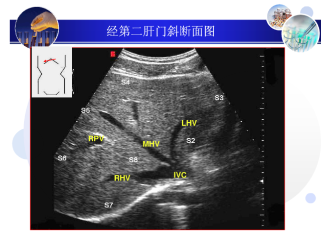 【超声微课堂】肝脏超声分段