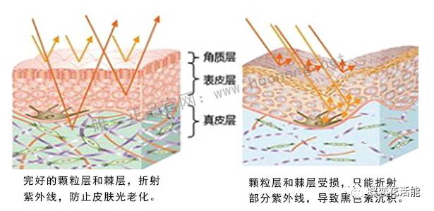扁平菱形的颗粒层具有折射紫外线防止皮肤光老化的作用,棘层所含有的