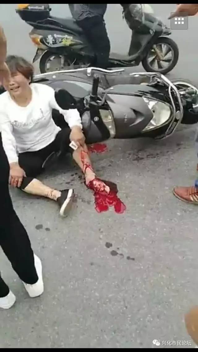 【视频】兴化戴南张家村大货车压掉妇女半只脚!伤者疼