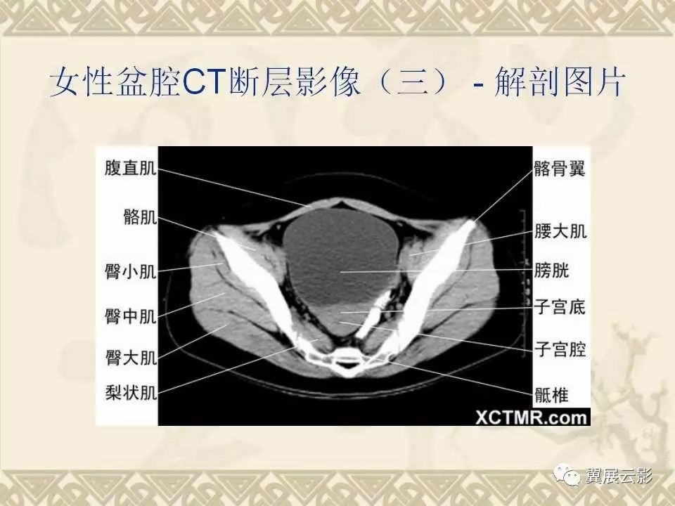胸,上腹部和盆腔ct图谱