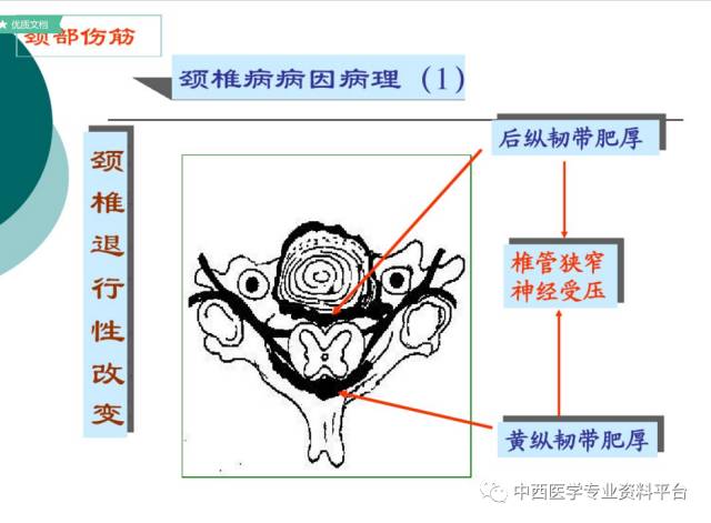 颈部筋伤上下全