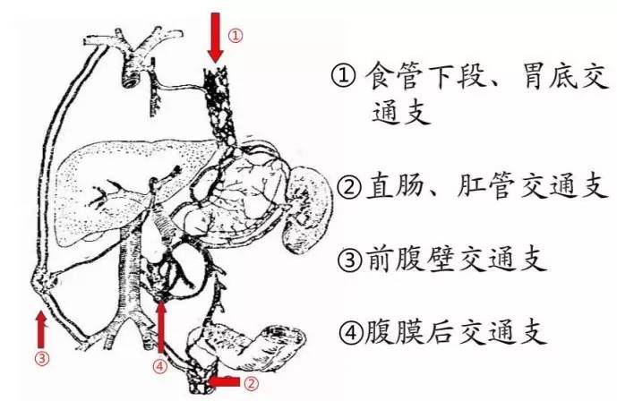 消化科普丨肝不好的看过来这次说说门脉高压症