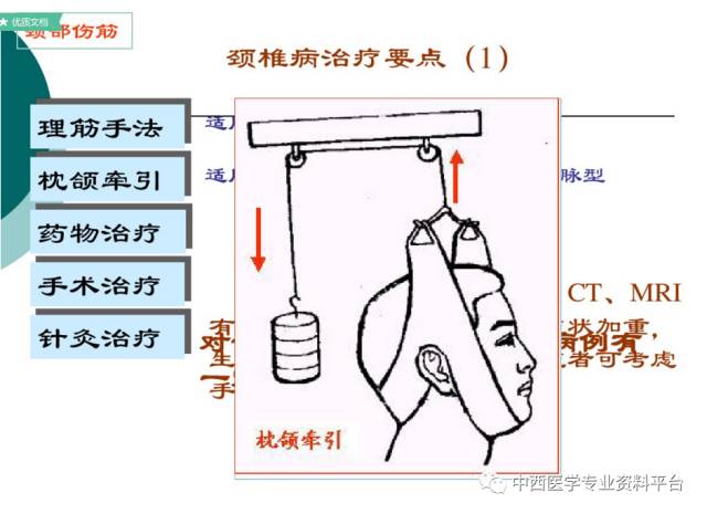 颈部筋伤上下全