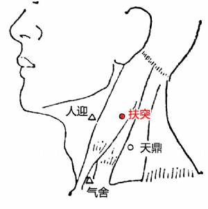 主穴:风池,天突,扶突,大椎.