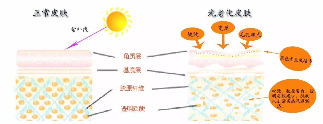 和治疗:康合素具有一下生理作用:1,趋化作用:促进上皮细胞(表皮细胞