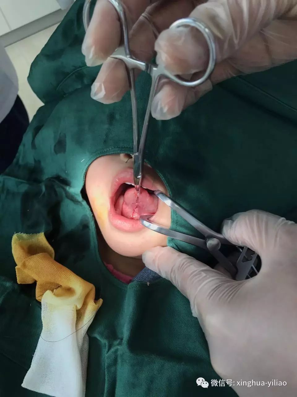 兴华口腔诊疗中心舌系带手术 最佳治疗时间:1岁半—2岁 龋齿 接待区