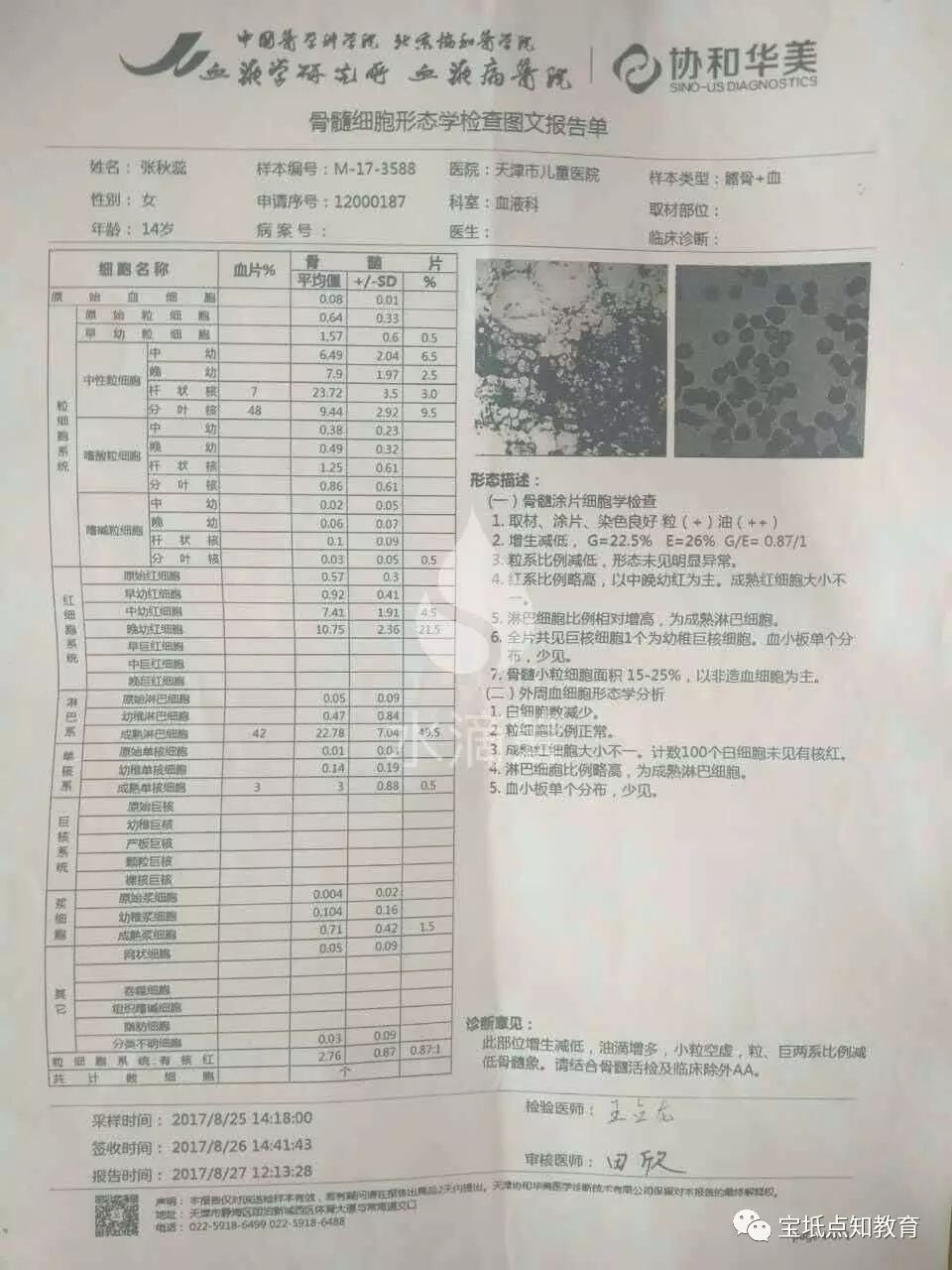 患有再生障碍性贫血,14岁少女张秋蕊