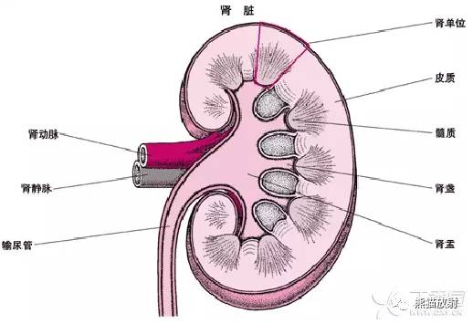 【双语病例】髓质海绵肾(IVP、CT)+鉴别