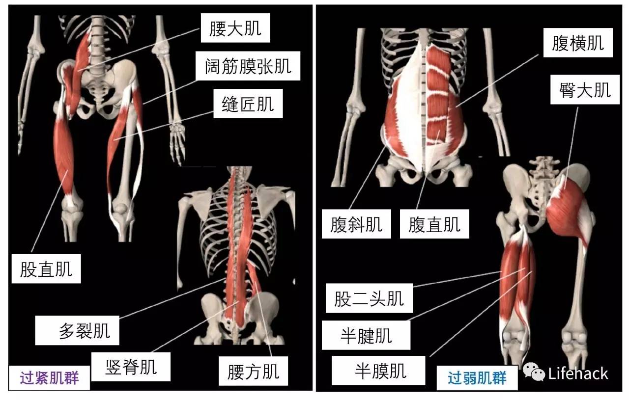 你这不是翘臀,是骨盆前倾!扎心了老铁