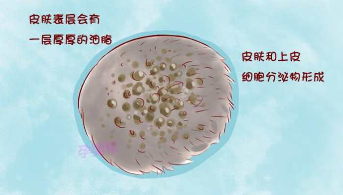 宝宝乳痂瞎抠易生病 2招正确清理法在这里!