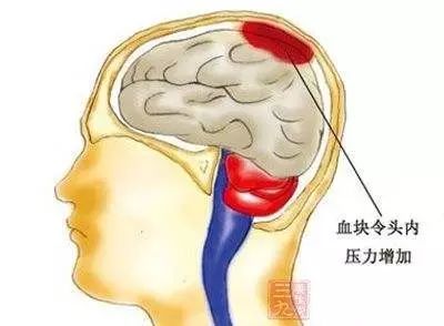 头顶受到撞击怎么办