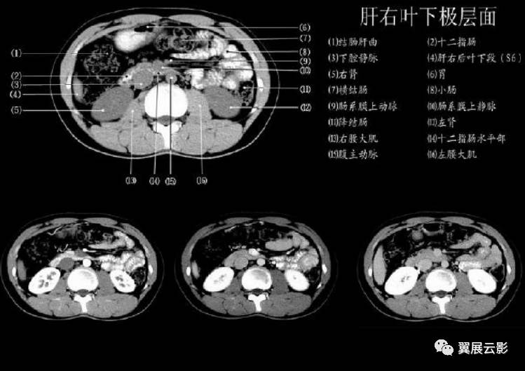 正常肝脏ct解剖