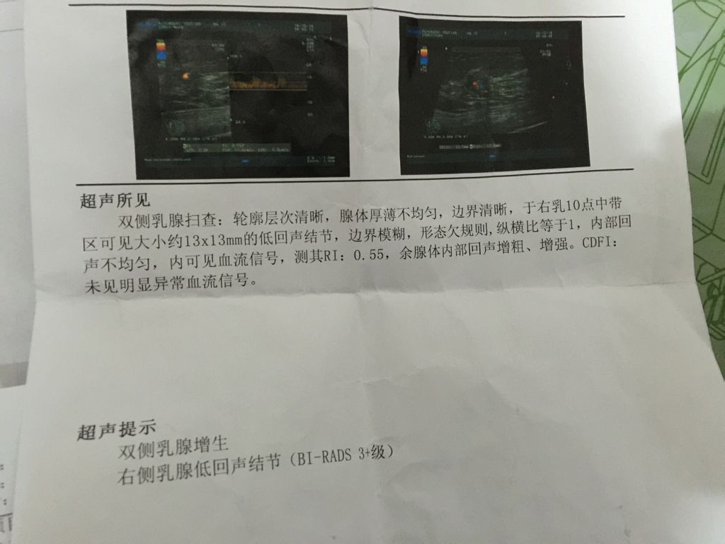 你应该知道的关于乳腺结节的事实分级