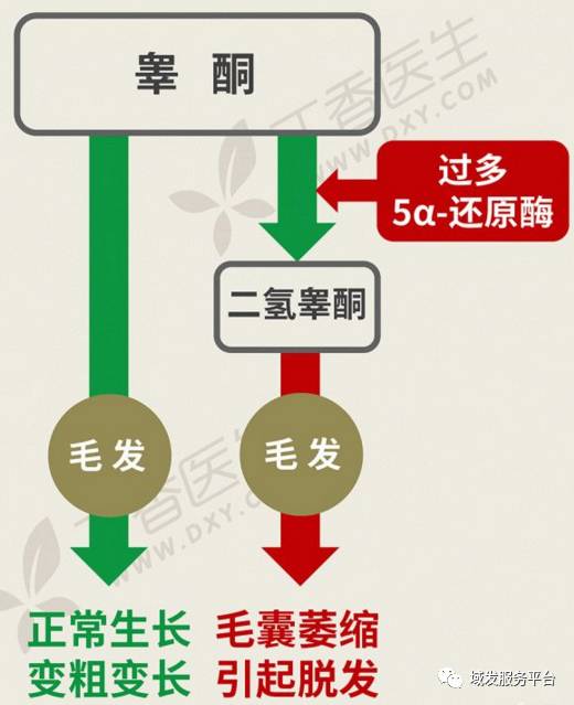 域发知识分享雄激素性脱发的元凶是谁