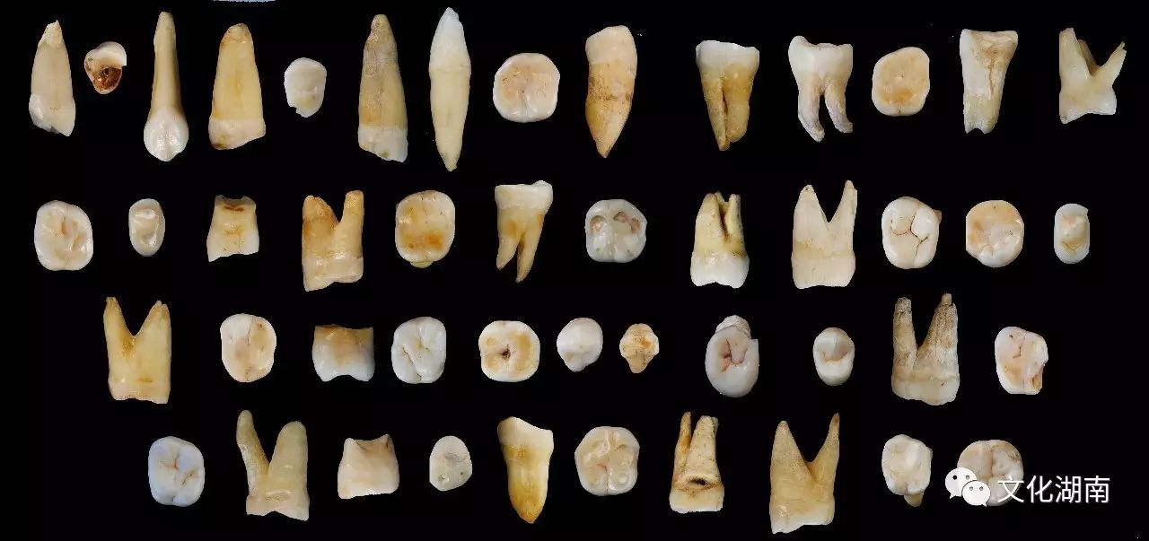 47颗道县人牙齿化石