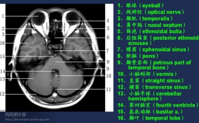 全身mri解剖图谱,速度收藏!