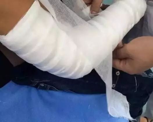 法庭聚焦丨盐边县8岁学生在操场上玩"逮猫猫"时手臂受伤,竟要求学校和