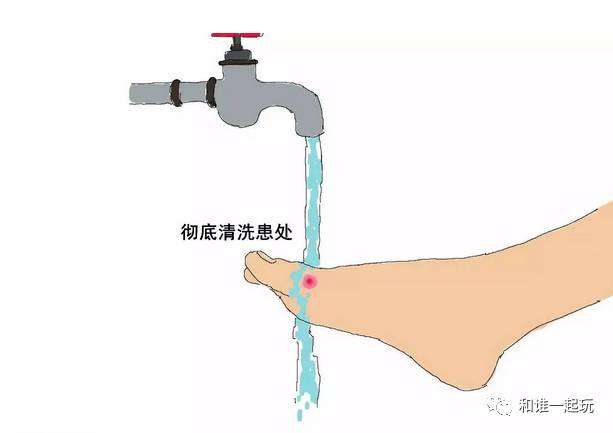 走路磨脚起水泡怎么办