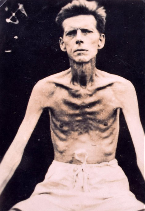 震惊的图片显示第二次世界大战中英国士兵在日本战俘营瘦骨嶙峋的状态
