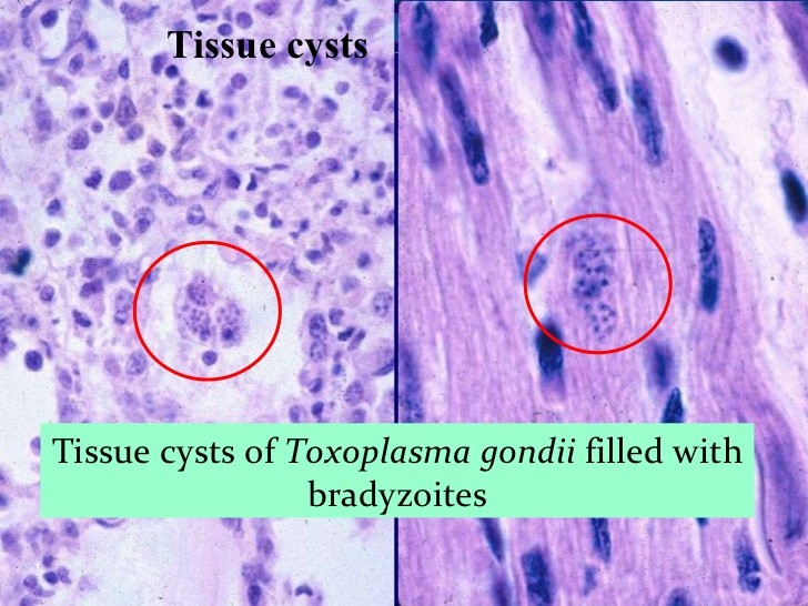 弓形虫包囊的存在会让人产生保护性免疫,这点没问题.