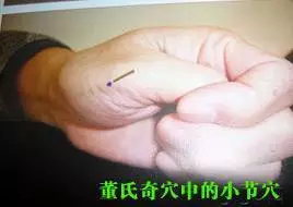 大鱼际的妙义—教你如何用手诊病治病