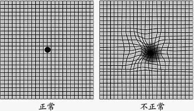 1张图测试你的眼睛是否正常,看出男人则安全,看出女人