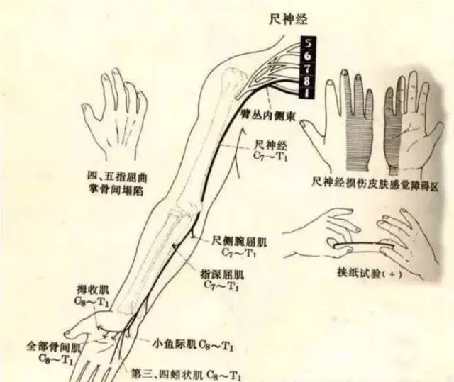 尺神经发自臂丛内侧束,在腋动,静脉之间出自腋窝,沿肱二头肌内侧缘伴