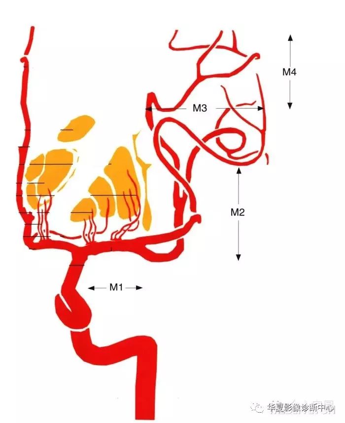 大脑中动脉分段详解简图dsa实体解剖