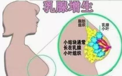 乳胀的原理_乳汁太少 不要怕 这样做就对了