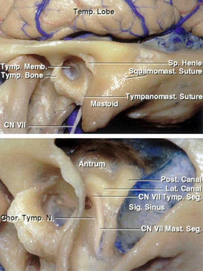 扩大经岩骨后入路手术技巧丨the neurosurgical atlas全文翻译