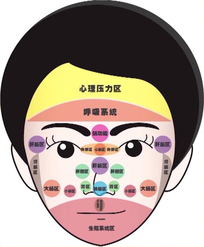 此技术发 2018年2月24日面部危险三角区里的痣能点掉吗?