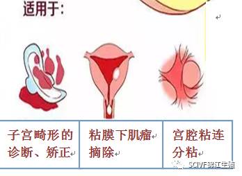 宫腔粘连,息肉,粘膜下肌瘤:宫腔镜手术—分离粘连,摘除息肉,肌瘤,恢复