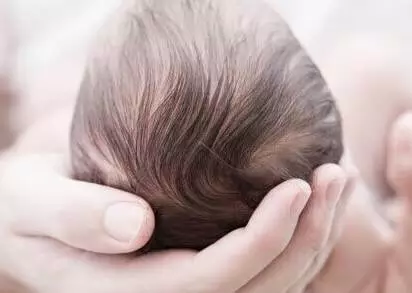 所以,婴儿出生后头发的数量就不可能再增添了