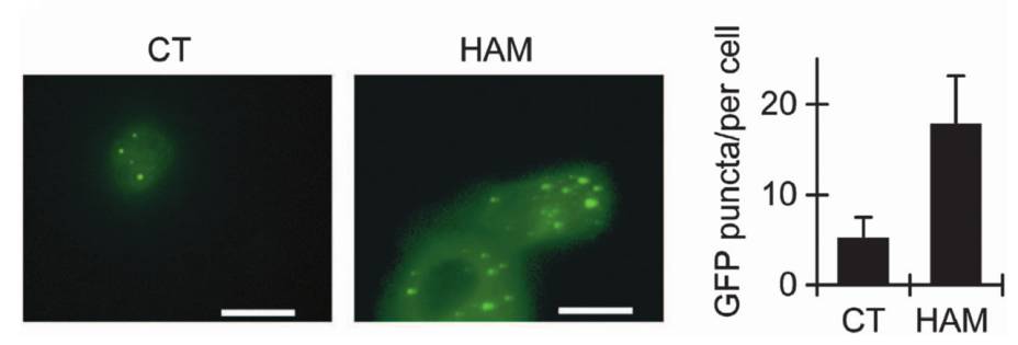 hamlet诱导caspase8调节胶质瘤细胞u87发生凋亡第一:早期的hamlet研究