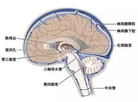 病例:脑室-腹腔分流术治疗交通性脑积水一例