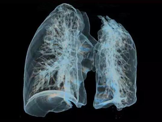 使用PD-1联合化疗治疗晚期非小细胞肺癌 有效