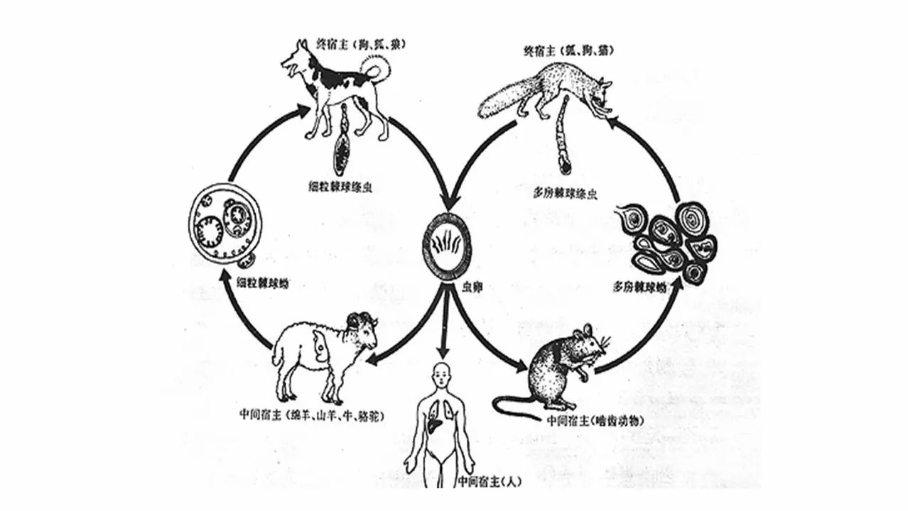 包虫病的影像学特点