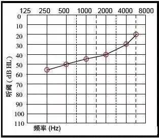 芜湖吉和路助听器:如何用听力图分析听力损失情况?