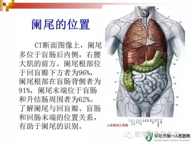 【精品讲座】急性阑尾炎的ct诊断