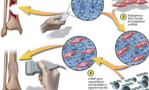 猪胫骨缺损修复再生示意(图片来源:《science translational