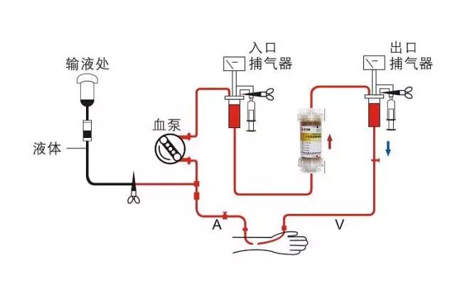 (血液灌流器原理示意图 希尔康公司一直与解放军总医院,军事医学院