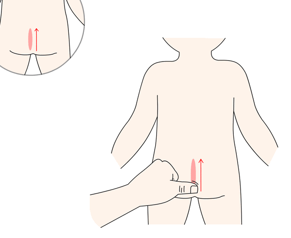 2,推上七节骨:用拇指侧面或食中两指面自尾骨端向上推至腰阳关穴(第4