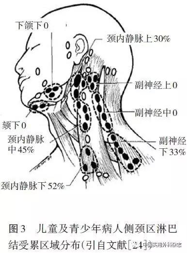 专题笔谈|儿童及青少年甲状腺癌淋巴结转移特点及治疗