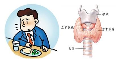 3分钟看懂甲亢有这些症状千万要小心