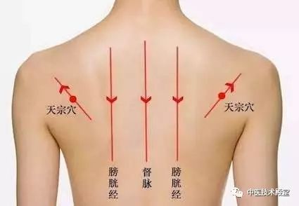 刮痧的范围是乳房的投影区与天宗穴所在的肩胛骨重叠的区域,刮痧的