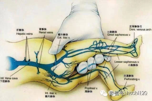 超全的小儿静脉穿刺技巧